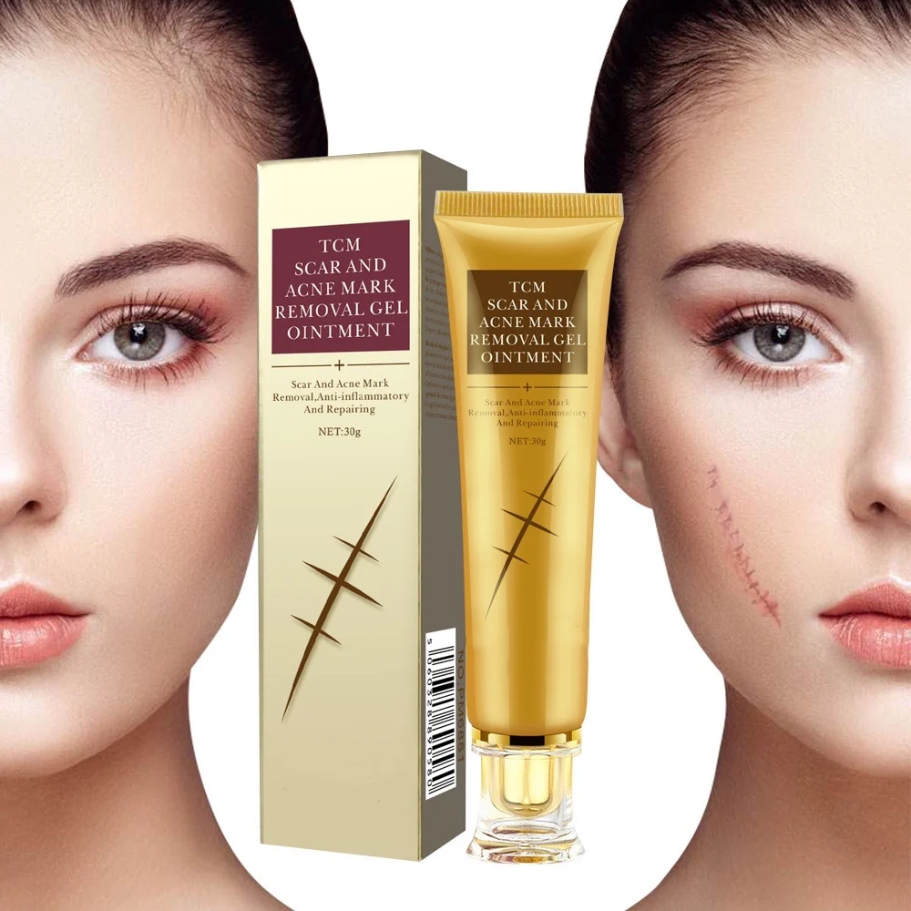 Skin Repair Face Black Dots Scar Removal Cream Facial Blackhead Scar repair Welcome to pick and buy.