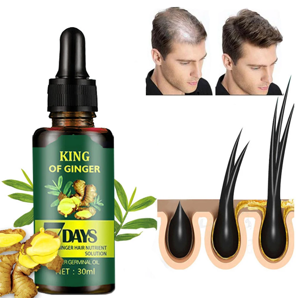 Private Label OEM Fast Natural Organic Herbal Custom Men Care Anti Hair Loss Serum Fall Ginger Hair Growth Oil for Hair Regrowth