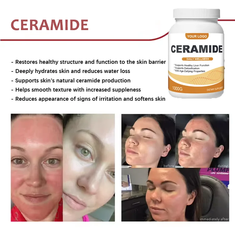 Herbal Supplements ceramide Collagen capsules Anti Aginger Skin Care 3 complex ceramide capsules