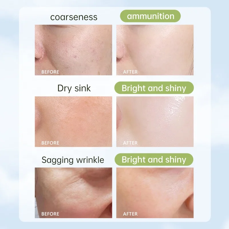 ESCP Private Label Hydrating Moisturizing Anti-Wrinkle Face Mask Ginger Lime Mango Coconut Honey Soothing Repair Sheet