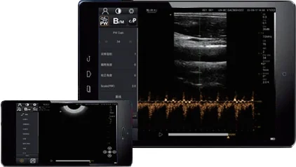 3.3MHz Wireless Convex WIFI Connected Handheld Ultrasound Machine Handheld Wireless Ultrasound Probe Portable Android IOS System