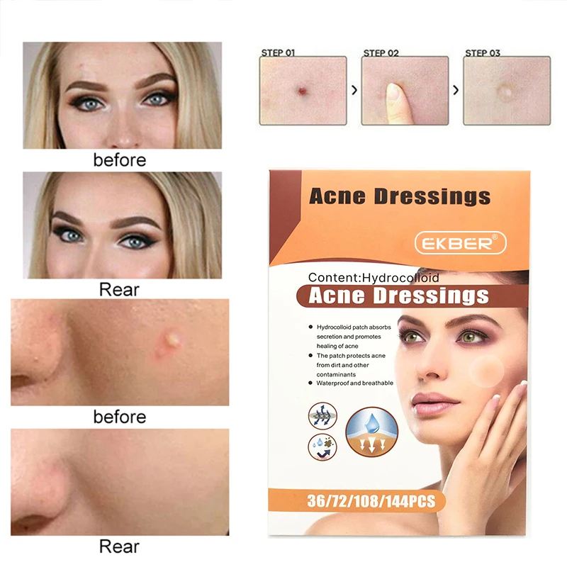 Hot Sale Cosmetics Acne Concealer Salicylic VC Healing Anti-Acne Pimple Patches Treatment Mask Wholesale