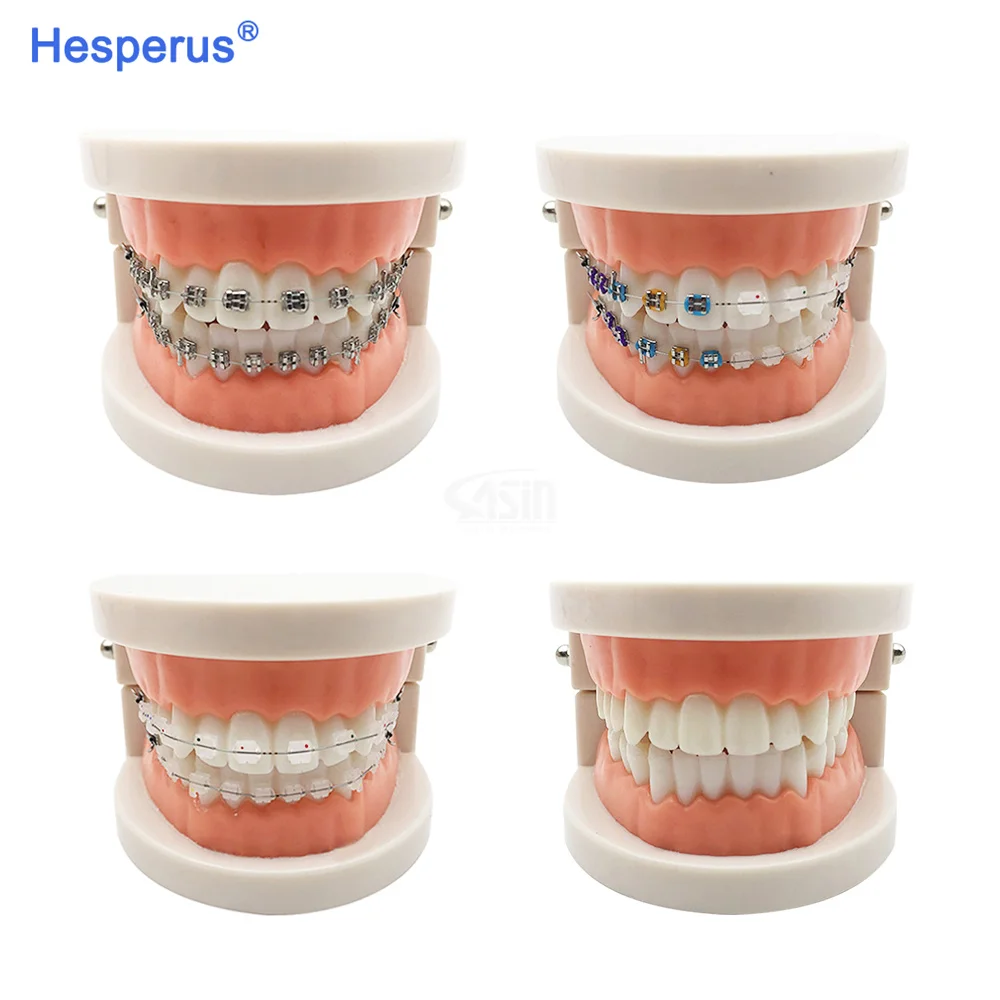 Dental Model Standard Dental Orthodontic Teeth Model With Braces Metal / Ceramic Brackets For Dentistry Education Study HESPERUS