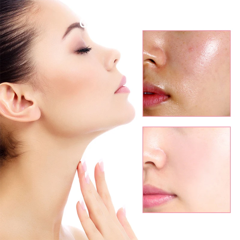 Gently Cleansing Face Skin Deep Clear Blackheads Whiteheads Dead Skin Non-irritating Non-dry Plucking Blackhead Clear Mud Stick