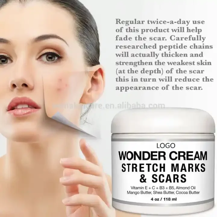 scars eraser minor bum acne stretch mark removing no scars cream hyperplastic scar removal cream for women man