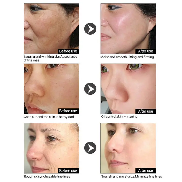 Beauty Skin Care 8 Types Serum Brightening Vitamin Sanil Collagen Serum Hyaluronic Acid Whitening Moisturizing Face Serum Set