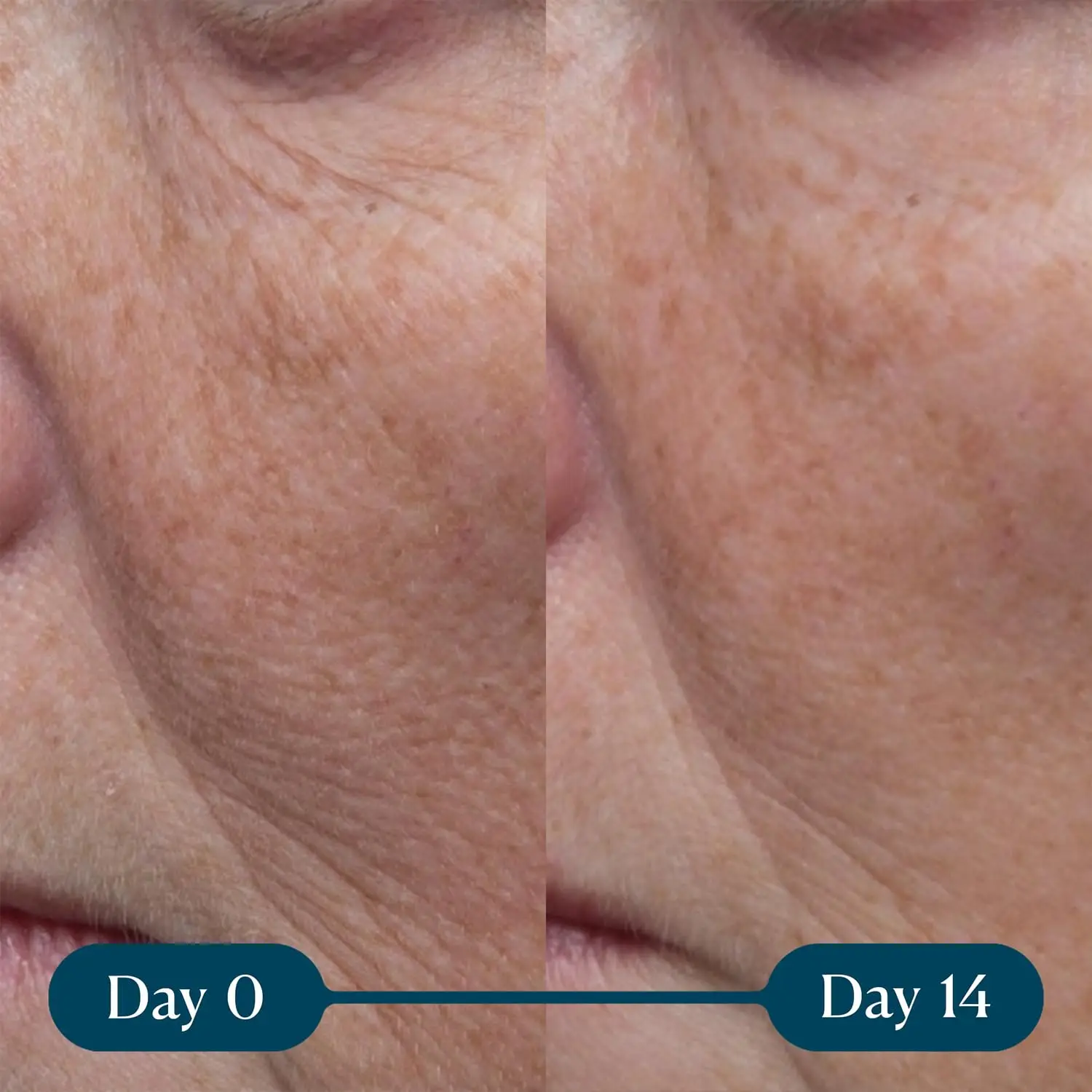 skincare cosmetic moisturizer facial private label whitening vitamins makeup skin peptides face care collagen anti wrinkle cream