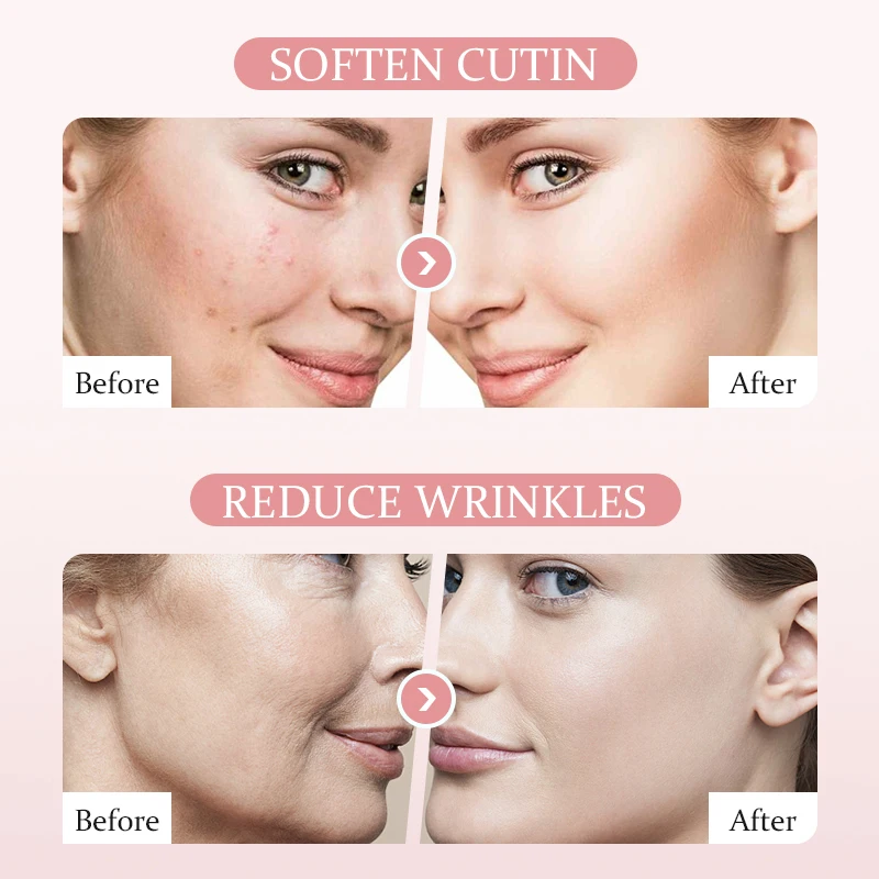 Private Label Retinol Wrinkles Removal Serum Anti Aging Firming Lifting Skin Care Hyaluronic Acid Whitening Cosmetic Serum