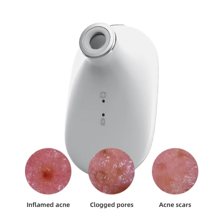 AI Facial Diagnosis Skin Analyzer Machine Portable Skin Scalp Analyzer 3d Skin Scanner Analyser