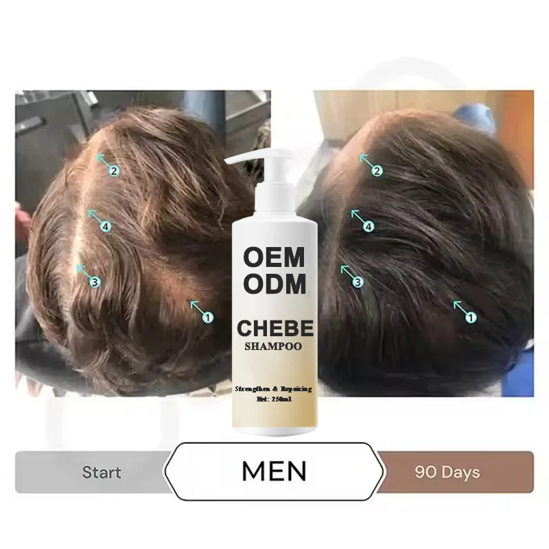 OEM Customs Logo Repair Damaged Hair Anti-Loss Anti-Dandruff 250ML Chebe Shampoo And Chebe Conditioner