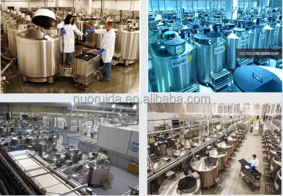 Liquid Nitrogen Semen Cryogenic Storage Tank Container