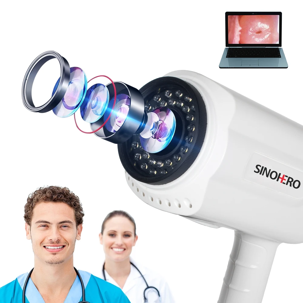 Video Colposcope Digital Colposcopy For Gynecology SINOHERO CS6 Cancare Cervical Colposcopy Machine
