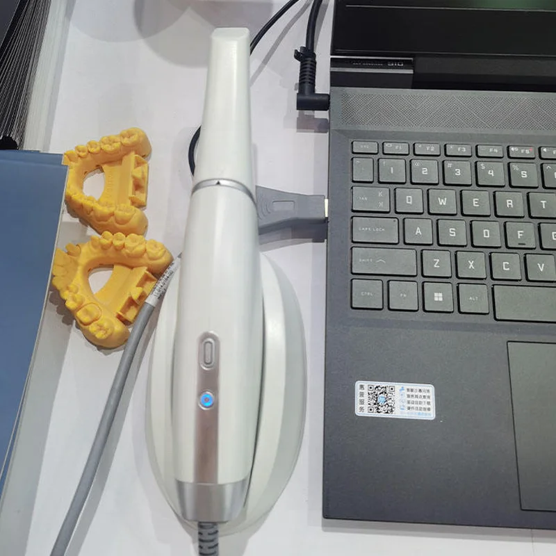 Chinese Popular Fussen  3d CADCAM  Intra Oral Scanner For Dental Clinic
