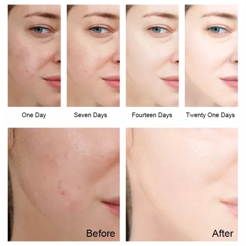 Частная этикетка крем и лосьон для лица (новинка) увлажняющий крем для лица против морщин и отбеливающий крем для лица