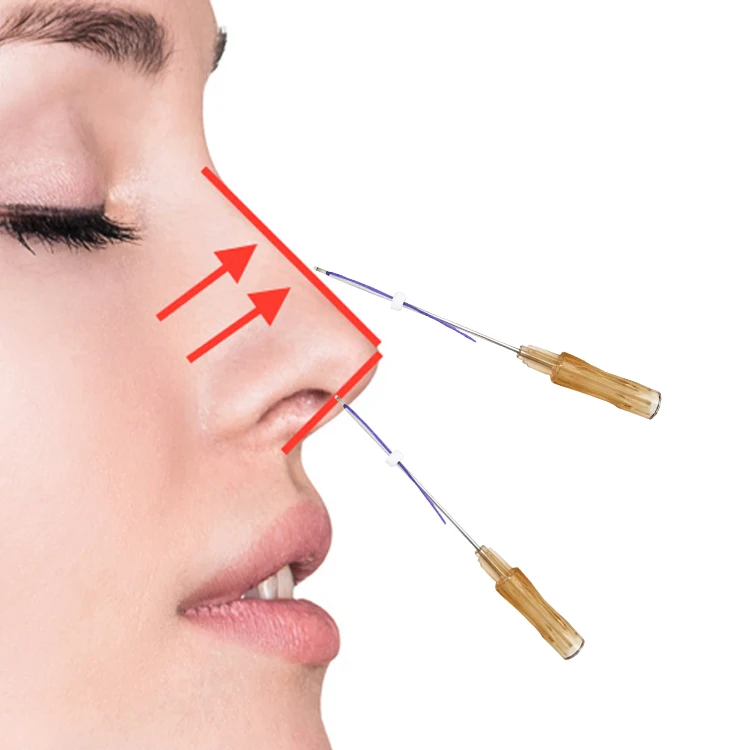 best selling products PDO lifting thread blunt cog molding lift for face nose blunt