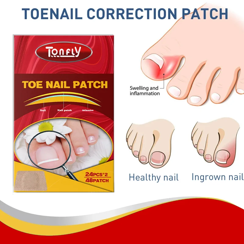 48Pcs Toenail Fungus Patch Breathable Nail Repair Patches Nail Ingrown Correction Stickers Waterproof Sticky Foot Care Tools