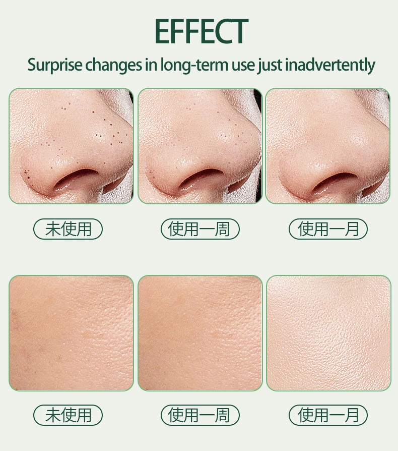 Deep Pore Head head Cleanser Exfoliating Spatula Personal Care Ems Vibrating Face Skin Scrubber Device