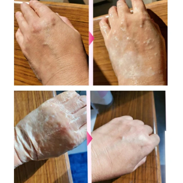 Ирикияс коллаген новый дистрибьютор лучшие отзывы о медицинских продуктах