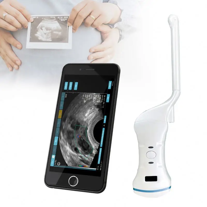 Medical Imaging Equipment Portable wireless wifi ultrasound scanner transvaginal ultrasound probe wireless