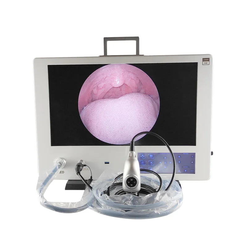 telepack all in one Portable Medical Endoscopic camera system  full HD rigid Endoscope Camera  with recording