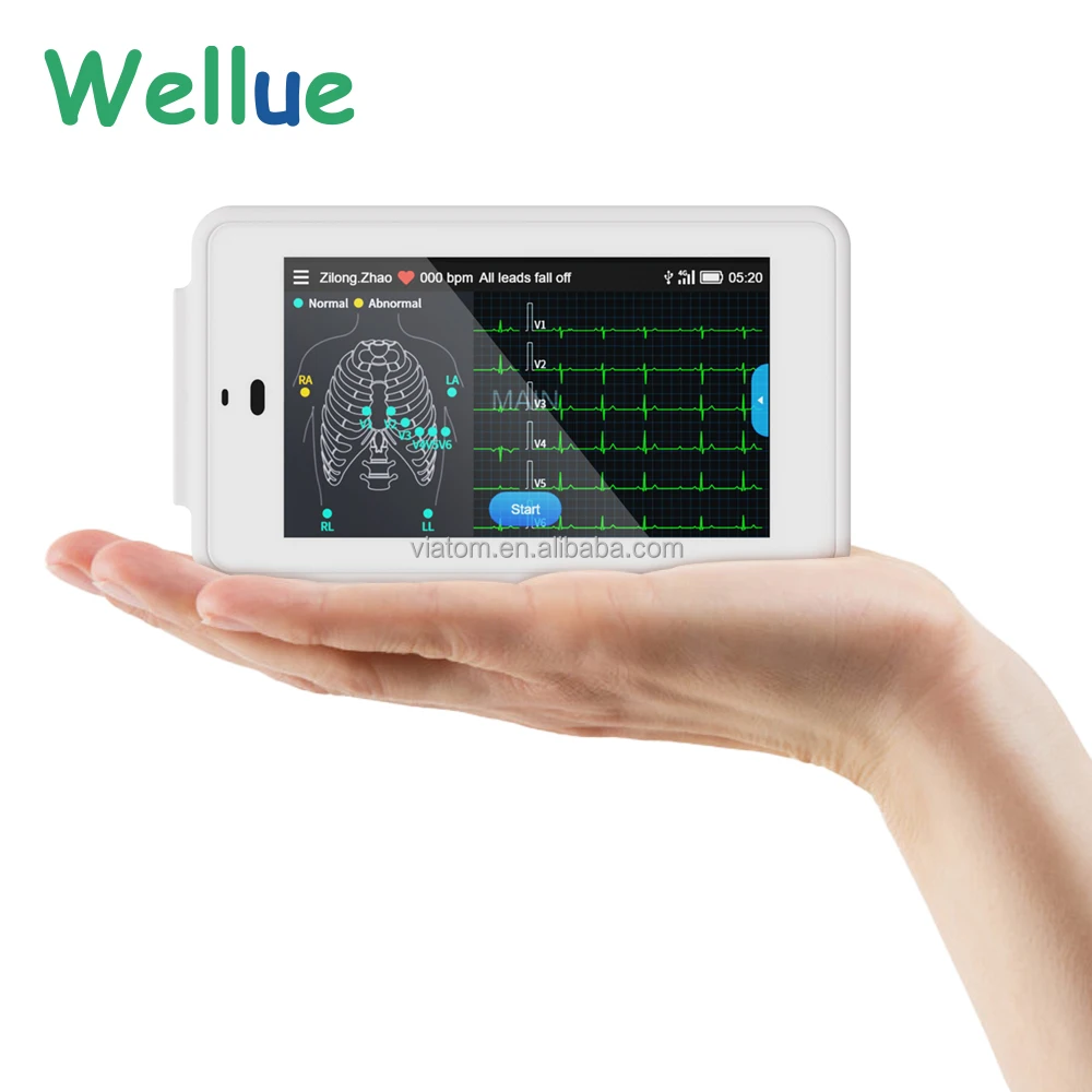 Viatom PC-ECG500 Pocket Ecg Monitor With Glasgow Analysis Color Display 12 Lead Wireless Health Monitors for Home