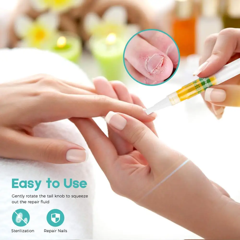 2PCS Nail Treatment From Fungus on Feet and Hand Disinfection Nail Fungal Treatment Oil Pen Manicure Treatment Tools