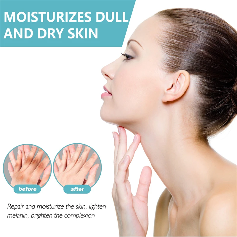 EELHOE 50g acanthosis nigricans therapy cream nape elbow knees knuckles back moisturizing brightening exfoliating cream