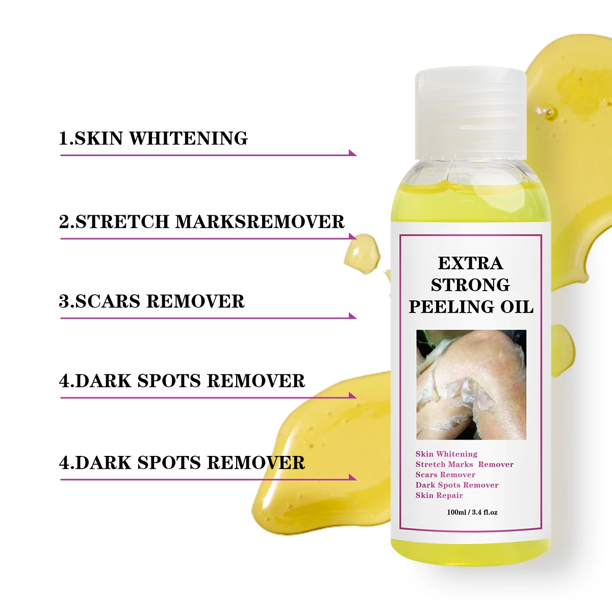 Private Label Extra Strong Whitening Dead Skin Dark Spot Remover Orange Peeling Oil Strength Yellow Bleaching Peel Oil