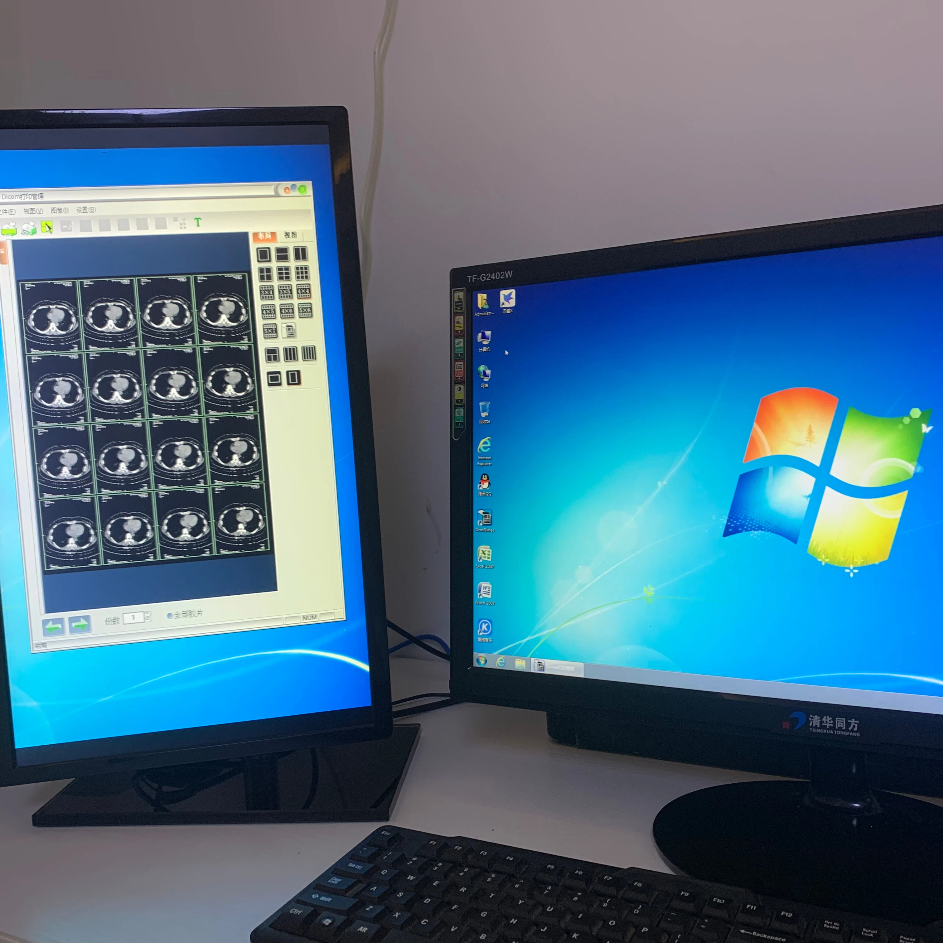 Blue Inkjet Medical Dry Film CT DR MRI X Ray Blue Transparent Film