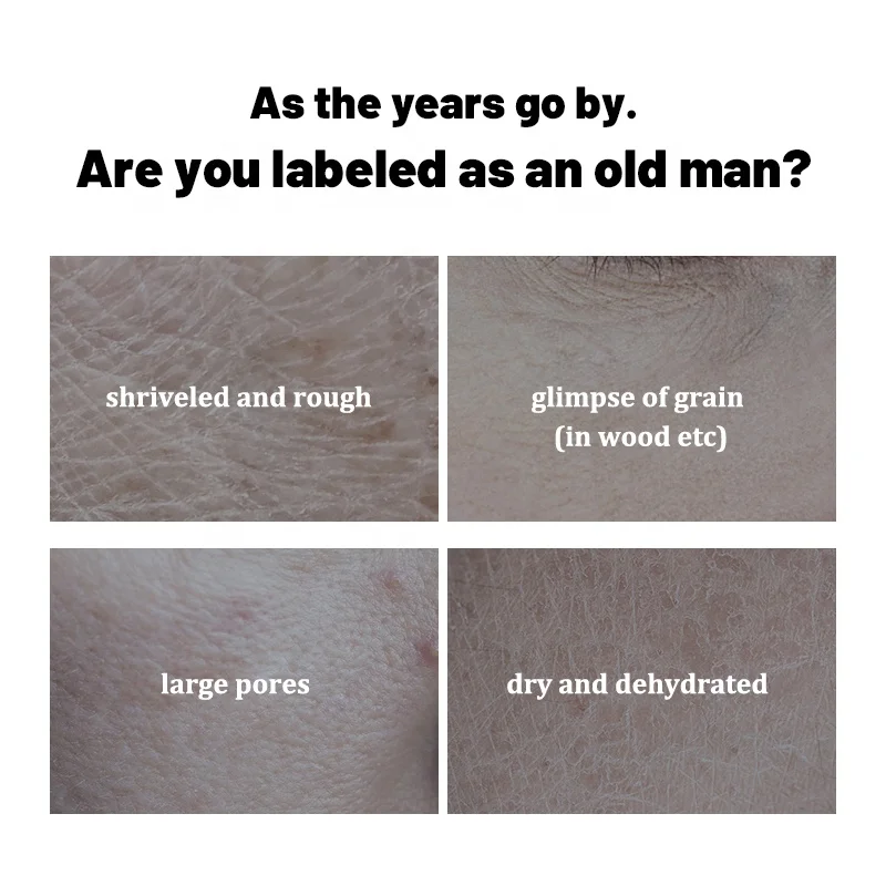 Azelaic Acid Pore Shrinking Glow Whitening Hyaluronic Niacinamide Peptides Antiwrinkle Acne Repair Face Serum For Sensitive Skin