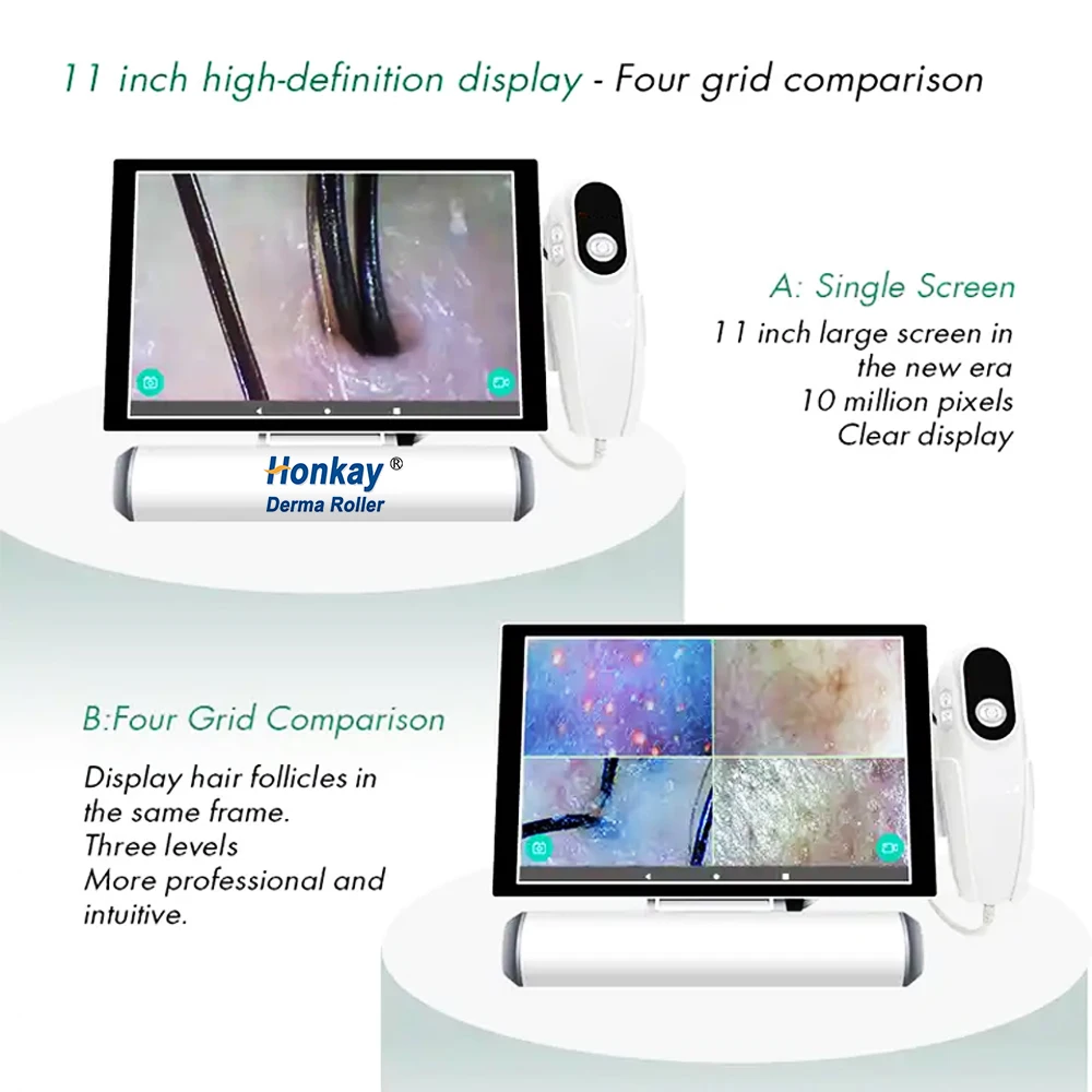 Head therapy specialized scalp analyzer 1080p HD image quality scalp analysis device