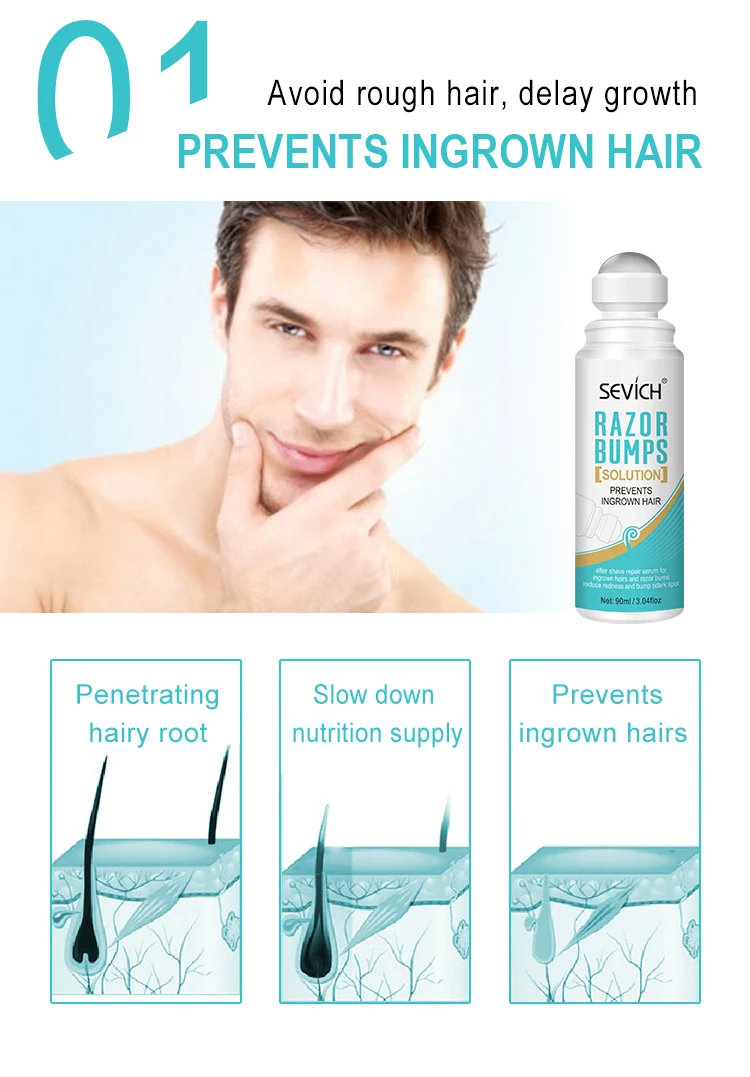  Professional aftershave private brand can eliminate and prevent ingrown