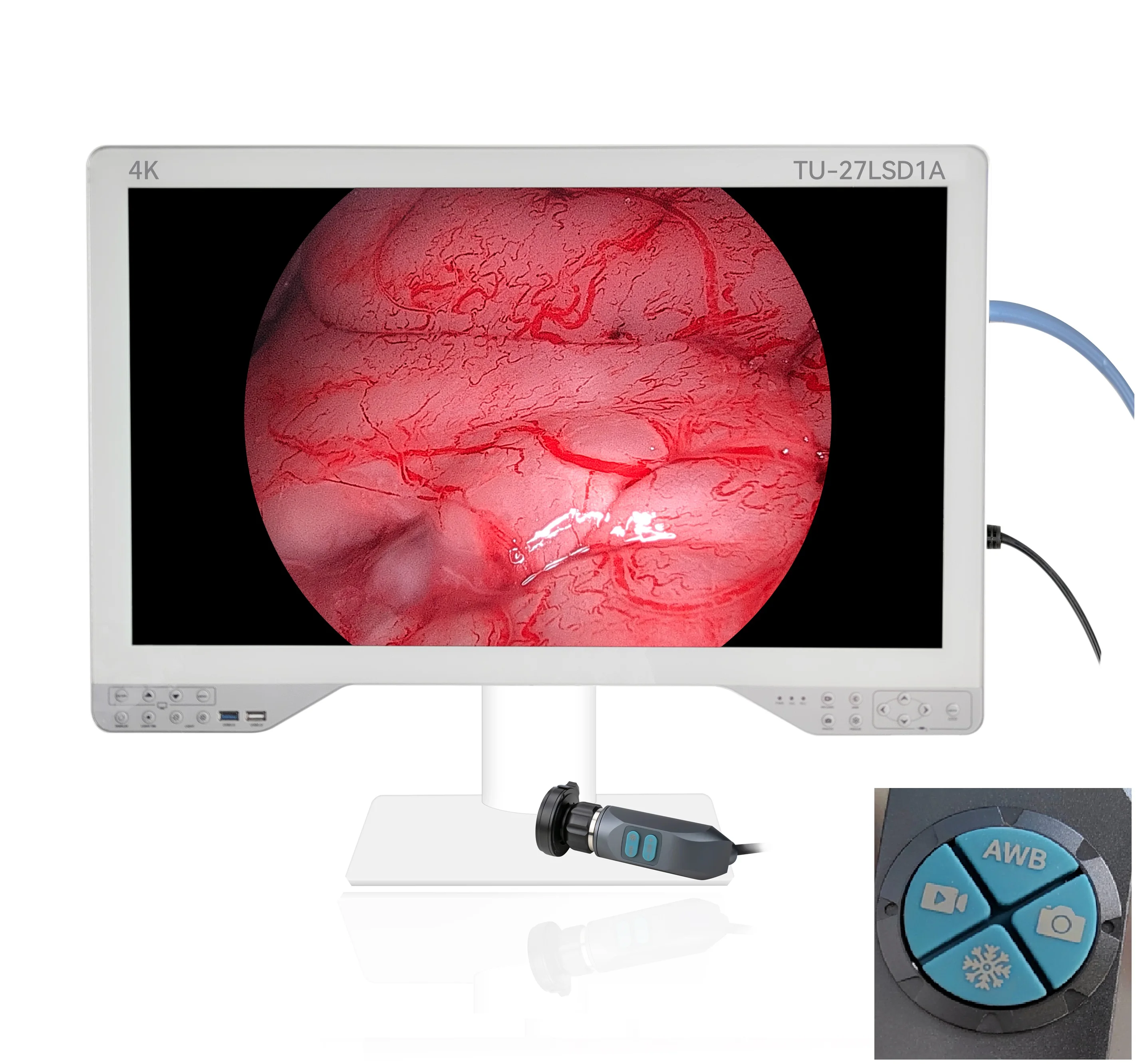 27 inches Surgical Monitor Ultra thin Screen 4-in-1 Endoscope Medical Camera with Built-in Light Source