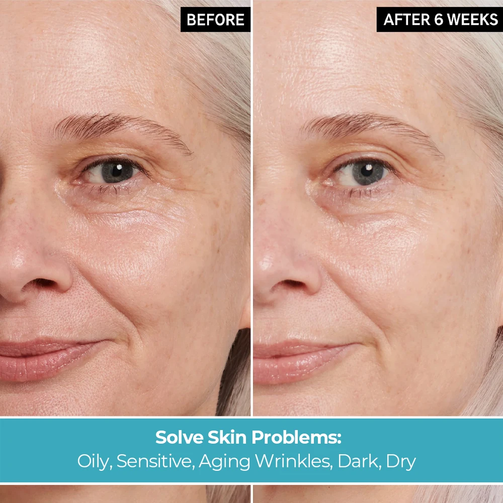 5 in 1 Face Cream Natural Skin Care 10% Hyaluronic Acid 30% Vitamin C 10% Pro Xyline 5% Collagen Whitening Face Cream for Women