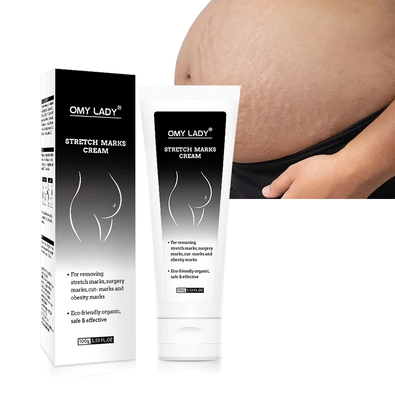 OMY LADY scar fade cream