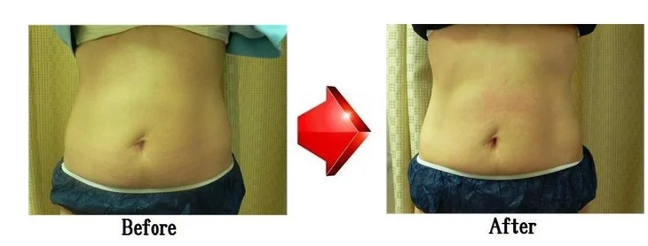 
Home easy use no side effects body fat burn cream stomach slimming 