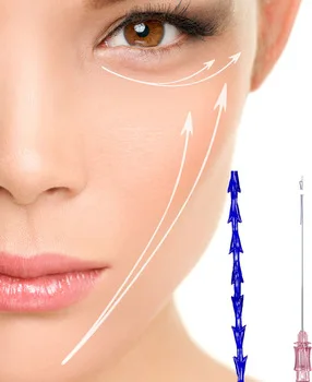 
Pdo Cog L Type Cannula 23G Thread Needle Nose Threads Lift Korea Beauty Nose Thread 