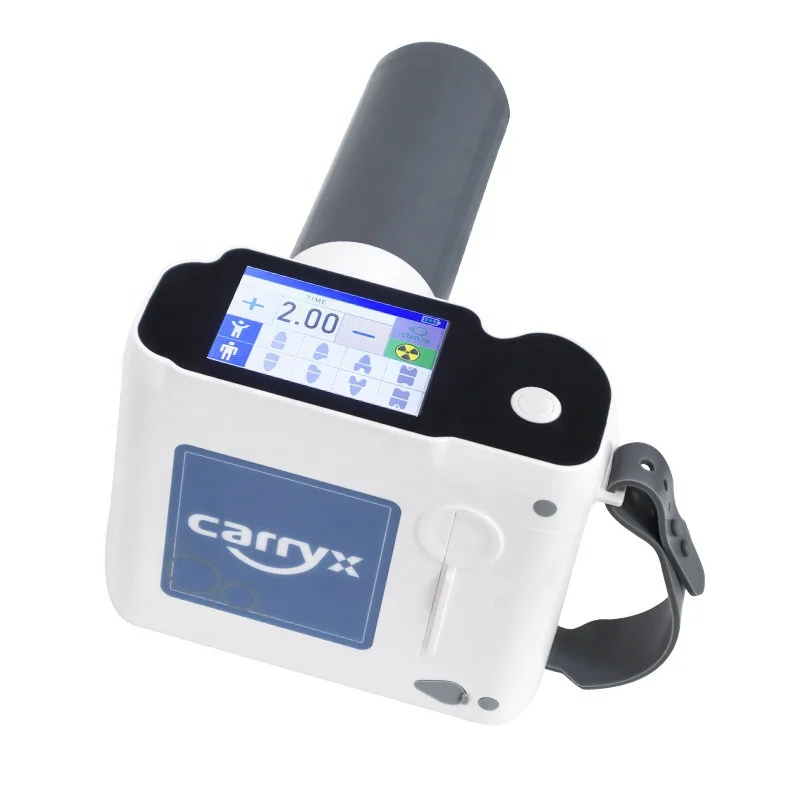 CarryX Brand X-ray Machine Lasts for 6 Months on a Single Charge HD LCD Touch Screen 70KV Portable X Ray