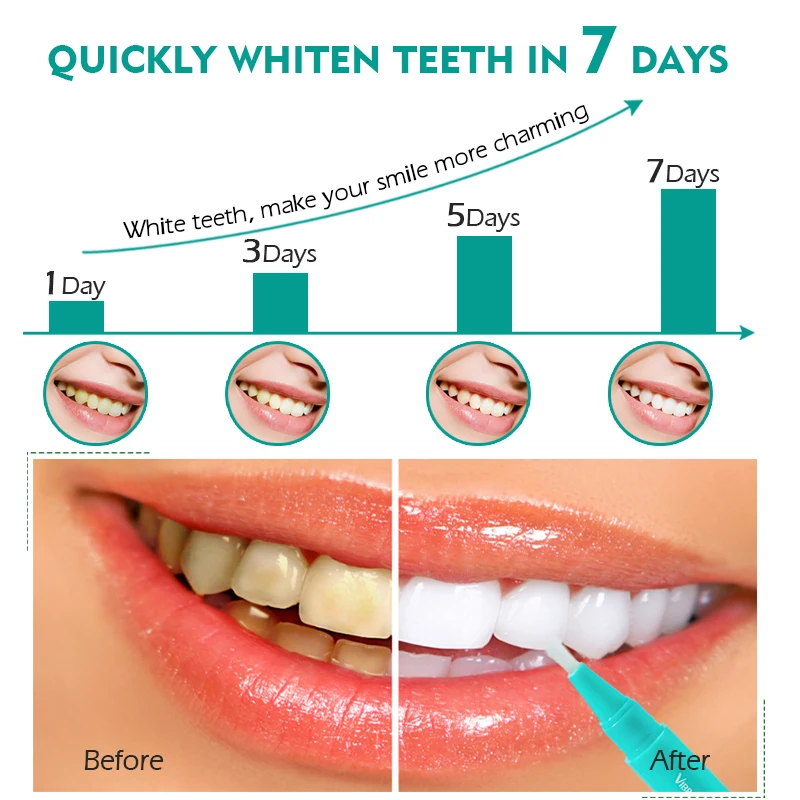 New Low Price Whiten Teeth Effectively And Fast Fast Remove Plaque Stains Bad Oral Smell Oral Teeth Care Dental