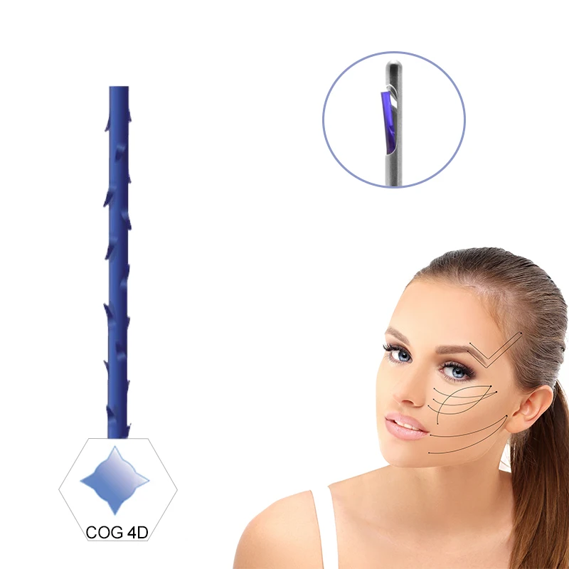 promotion progress 3d/4d pdo 18g 150mm thread r cannula face lifting cog liting thread