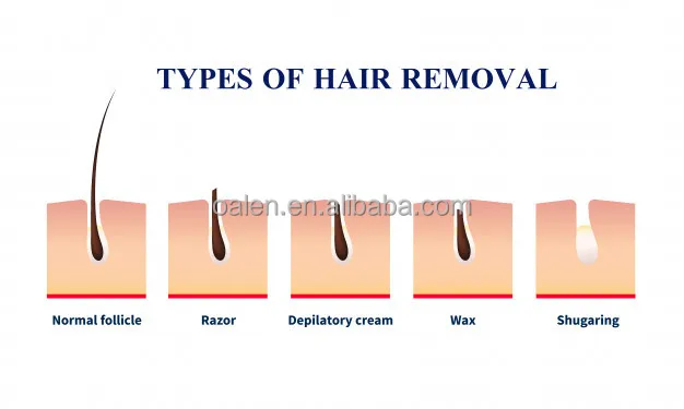 Natural Ingredient Face Arm Leg Armpit Use Hair Stop Growth Spray Hair Inhibitor Spray