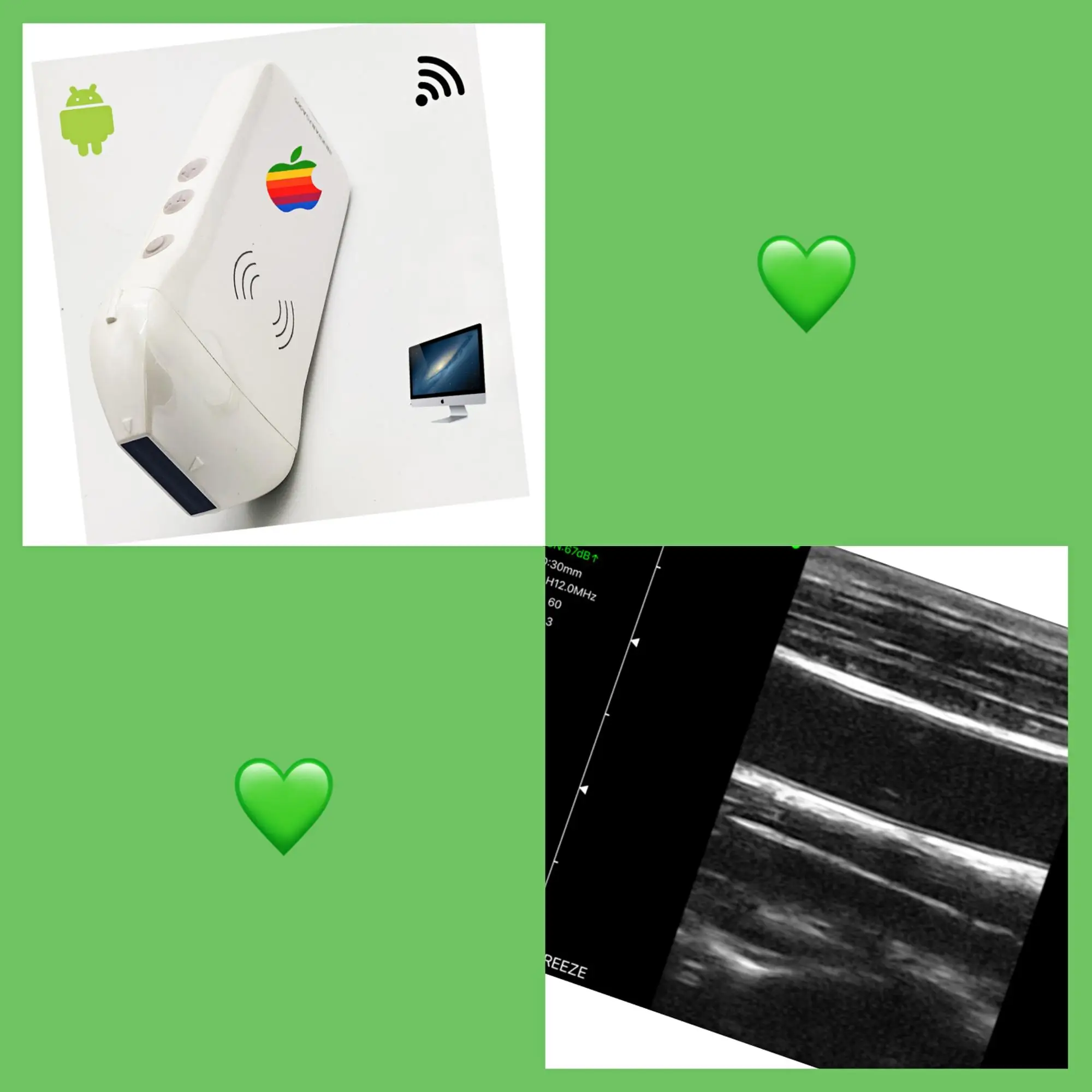 
Hospital wifi doppler ultrasound 192 elements probe for biopsy and vein finder 