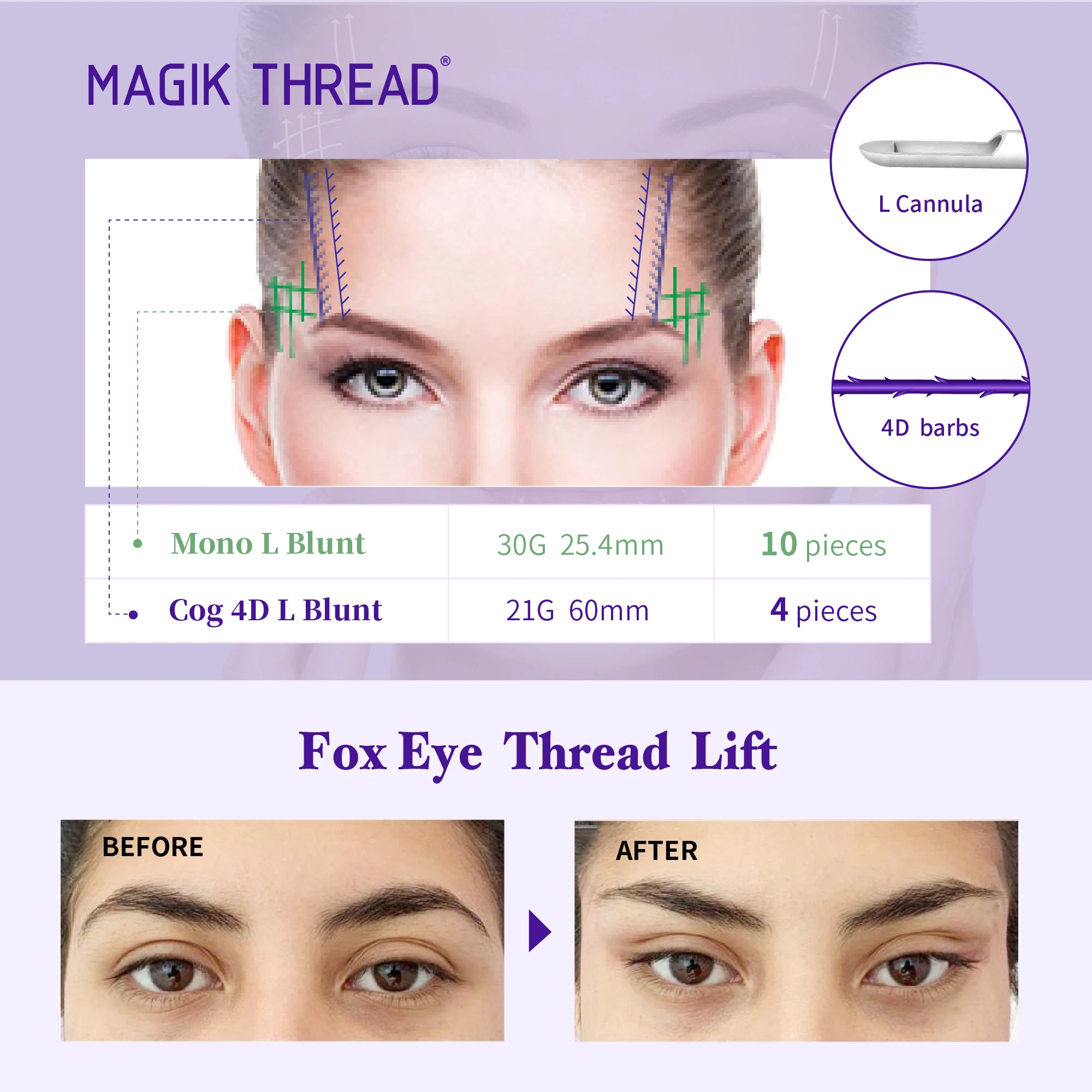 Magik нитки медицинская эстетика нить теневая продукция Лисий глаз