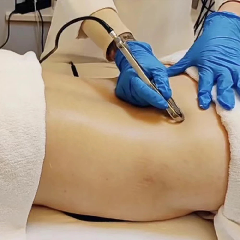 Самая популярная машина 6 в 1 diathermy tecar RF пациентная пластина оборудование для физиотерапии