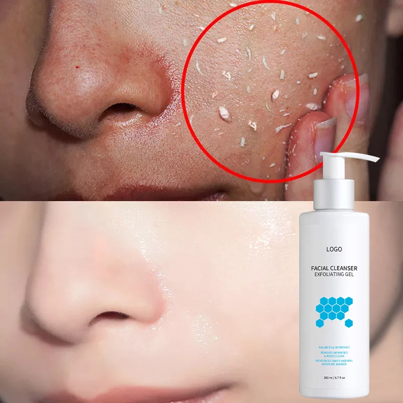 Private Label Organic Exfoliator Remove Dead Exfoliating Peeling Skin Gel Body Scrub Face Wash Facial Cleanser