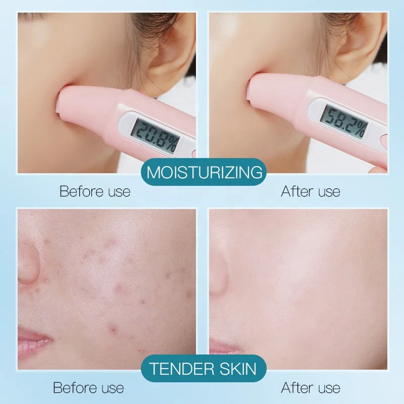 OEM Chinese Guangzhou Facial Mask Spot Probiotics Bifid Yeast Revitalizing Face Sheet Wholesale Low Price Facial Mask