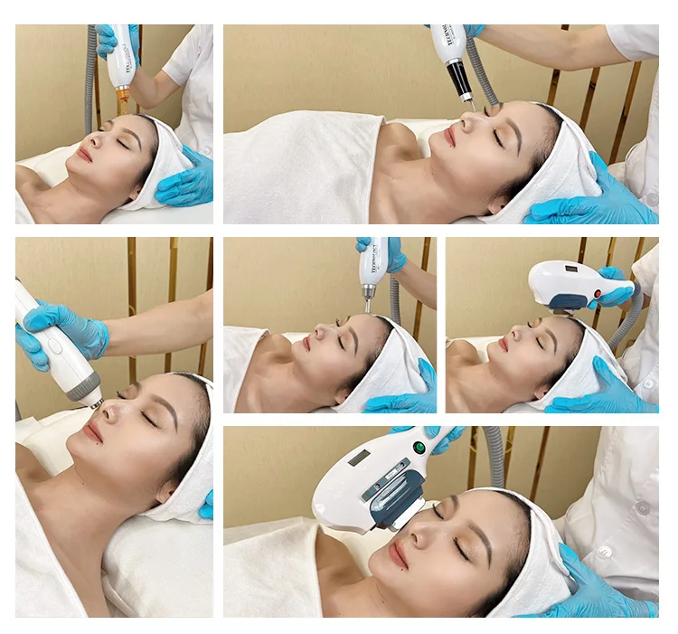 Hair Removal Big Power Laser Hair Removal Machine Laser Hair Removal Machine Price In Pakistan