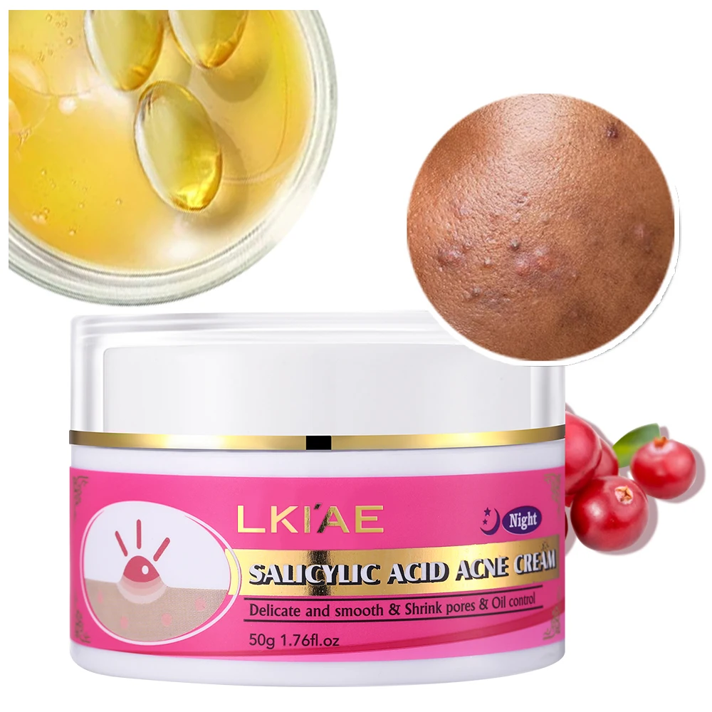 Shrink Pores Anti Acne Cream Retinol Salicylic Acid Pimples Acne Scar Removal Delicate Texture Face Cream
