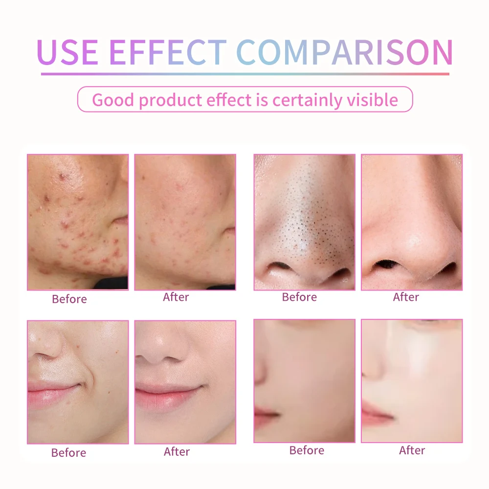 Wholesale Wireless Led Beauty face Mask Infrared Home Use Led Mask Light Therapy Led Facial Masks