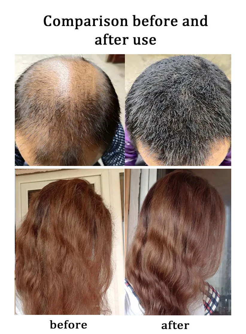 Organic Natural Anti Hair Loss Shampoo Growth Hair Products Private Label